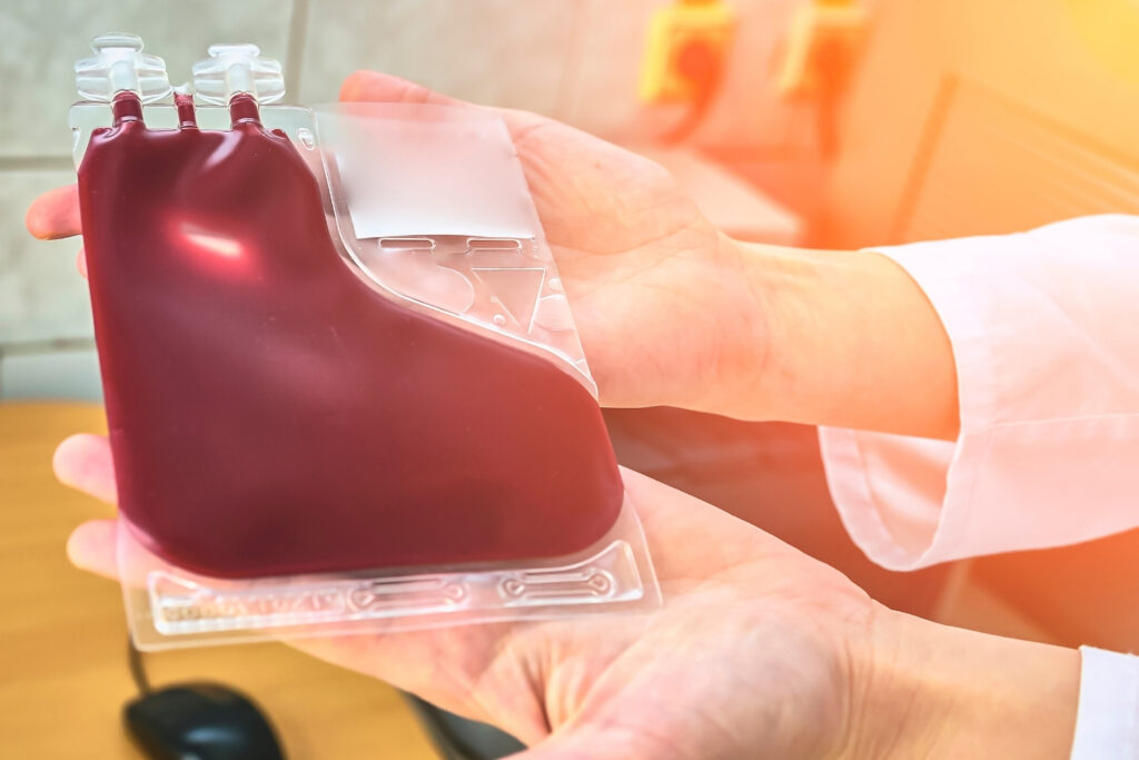 Immagine esempio con sacca di sangue da cordone ombelicale raccolto per la donazione