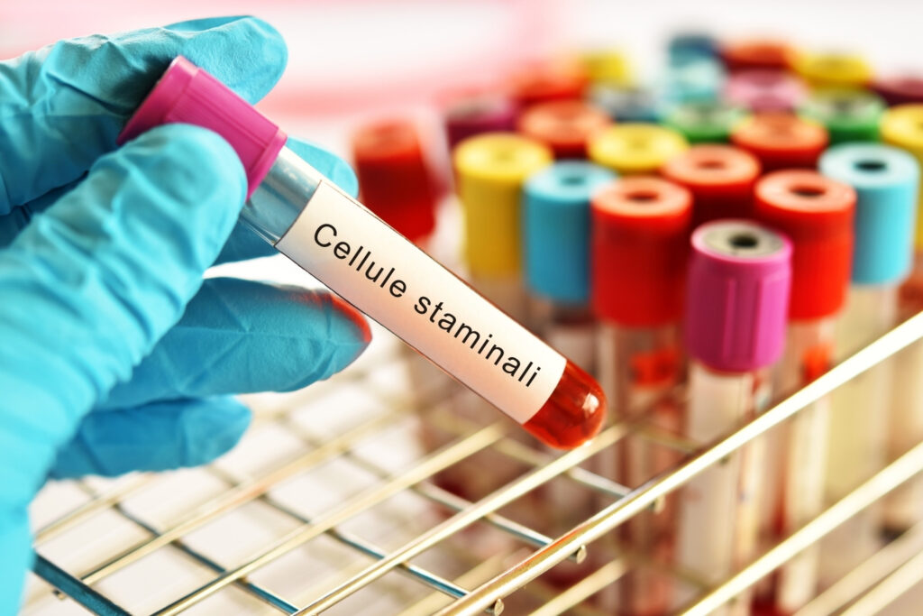 Immagine esempio per articolo su a cosa serve donare le cellule staminali emopoietiche cordonali